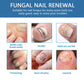 Nail Fungus Treatment Solution