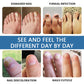 Nail Fungus Treatment Solution