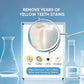 💖Niacinamide toothpaste for radiantly white teeth🦷Pearly white teeth🦷The new secret weapon for your smile!