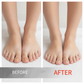 🖤See Real Results Faster🖤2 bottles Nail Repair Essence for Damaged Nails💅🏻