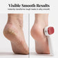 🎉Buy 2 Get 1 Free🦶 Double Sided Stainless Steel Foot Scraper Callus Remover ✨