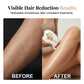 🥳2026 HOT SALE🥳💞50K+ SOLD!✨⏰ 50% OFF + Free Shipping! IPL Ice-Cooling Hair Removal – Painless, long-lasting. A bit pricey, but worth every penny. 999,999 flashes, full body use. 💎❄️